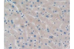 Detection of PPM1A in Human Liver Tissue using Polyclonal Antibody to Protein Phosphatase, Mg2+/Mn2+ Dependent 1A (PPM1A) (PPM1A anticorps  (AA 2-382))