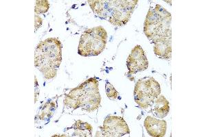 Immunohistochemistry of paraffin-embedded human gastric using STK3 antibody at dilution of 1:100 (x40 lens).