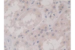 Detection of KIF18A in Human Kidney Tissue using Polyclonal Antibody to Kinesin Family, Member 18A (KIF18A)
