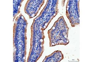IHC analysis of Taperin using anti-Taperin antibody (ABIN7603730).