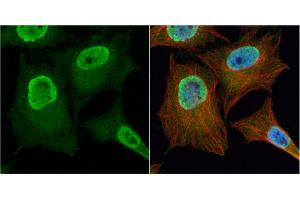ICC/IF Image PGAM2 antibody detects PGAM2 protein at cytoplasm and nucleus by immunofluorescent analysis.