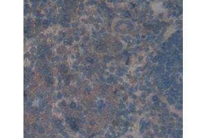 IHC-P analysis of spleen tissue, with DAB staining. (Protein phosphatase 1 (AA 335-578), (Regulatory Subunit 15A) anticorps)