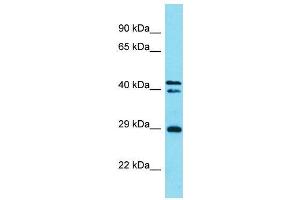 Host:  Rabbit  Target Name:  Helt  Sample Type:  Mouse Stomach lysates  Antibody Dilution:  1.