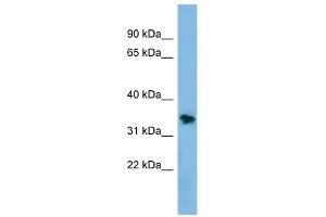 NSMCE1 antibody used at 1 ug/ml to detect target protein. (NSMCE1 anticorps)