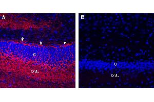 Expression of GAP43 in rat hippocampus.