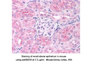 Image no. 1 for anti-Egl-9 Family Hypoxia Inducible Factor 1 (EGLN1) (AA 300-400) antibody (ABIN363514)