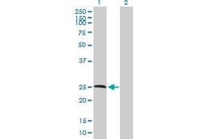 Western Blot analysis of RNASE11 expression in transfected 293T cell line by RNASE11 MaxPab polyclonal antibody. (RNASE11 anticorps  (AA 1-199))