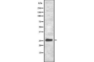 Western blot analysis NET-5 using HeLa whole cell lysates (Tetraspanin 9 anticorps  (Internal Region))