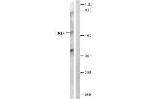 Western blot analysis of extracts from CV-1 cells treated with forsklin. (LKB1 anticorps)
