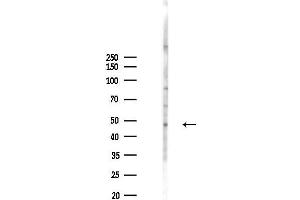 anti-RecQ Protein-Like 5 (RECQL5) (C-Term) antibody