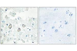 Immunohistochemistry analysis of paraffin-embedded human brain tissue using DOK7 antibody. (DOK7 anticorps  (N-Term))