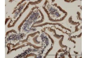 Image no. 3 for anti-Cell Death-Inducing DFFA-Like Effector B (CIDEB) (AA 3-111) antibody (ABIN599215) (CIDEB anticorps  (AA 3-111))