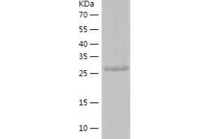 Western Blotting (WB) image for Ankyrin Repeat and SOCS Box Containing 8 (ASB8) (AA 1-288) protein (His-IF2DI Tag) (ABIN7121836)