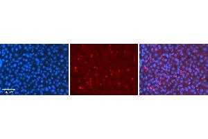 Rabbit Anti-MLX Antibody   Formalin Fixed Paraffin Embedded Tissue: Human Liver Tissue Observed Staining: Cytoplasm in speckles in hepatocytes Primary Antibody Concentration: 1:100 Other Working Concentrations: 1:600 Secondary Antibody: Donkey anti-Rabbit-Cy3 Secondary Antibody Concentration: 1:200 Magnification: 20X Exposure Time: 0. (MLX anticorps  (C-Term))