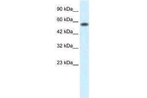 Human Jurkat; WB Suggested Anti-PCYOX1 Antibody Titration: 0. (PCYOX1 anticorps  (C-Term))