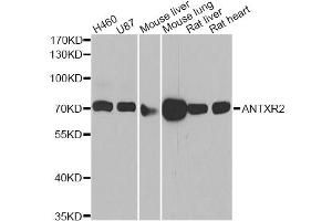 Western blot analysis of extracts of various cell lines, using ANTXR2 antibody. (ANTXR2 anticorps)