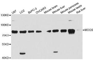 Western blot analysis of extracts of various cell lines, using MOGS antibody (ABIN6292972) at 1:3000 dilution. (GCS1 anticorps)