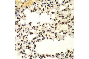 Immunohistochemistry of paraffin-embedded mouse lung using SUMO2 antibody (ABIN6128719, ABIN6148726, ABIN6148728 and ABIN6218594) at dilution of 1:100 (40x lens). (SUMO2 anticorps  (AA 1-95))