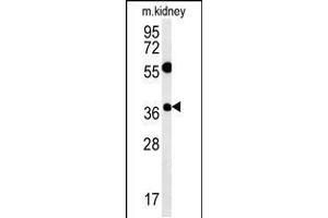 Western blot analysis in mouse kidney tissue lysates (15ug/lane). (Tetraspanin 3 anticorps  (AA 90-117))