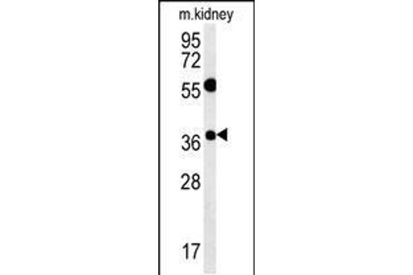 Tetraspanin 3 anticorps  (AA 90-117)