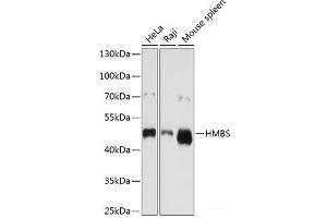 Western blot analysis of extracts of various cell lines using HMBS Polyclonal Antibody at dilution of 1:1000. (HMBS anticorps)