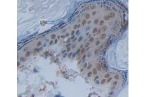 Figure. (NFIX anticorps  (AA 13-298))