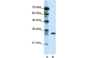 WB Suggested Anti-TSFM Antibody Titration:  1. (TSFM anticorps  (C-Term))