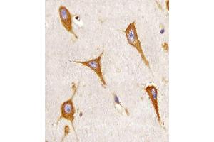 (ABIN6243055 and ABIN6577107) staining B in human brain sections by Immunohistochemistry (IHC-P - paraformaldehyde-fixed, paraffin-embedded sections). (BCAP31 anticorps  (AA 1-246))