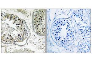 Immunohistochemistry analysis of paraffin-embedded human testis tissue, using CHST13 antibody. (CHST13 anticorps  (Internal Region))