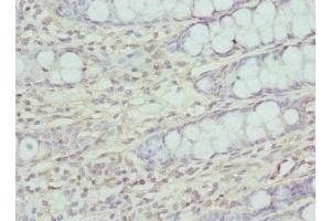 Immunohistochemistry of paraffin-embedded human colon tissue using ABIN7147359 at dilution of 1:100 (CP110 anticorps  (AA 1-280))