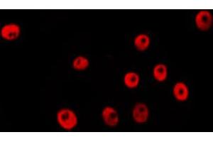 ABIN6274044 staining Hela by IF/ICC. (RNF20 anticorps  (Internal Region))