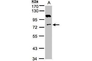 WB Image Sample(30 ug whole cell lysate) A:A431, 7. (Adenylate Kinase 7 anticorps)