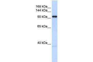 WB Suggested Anti-OGT Antibody Titration: 0. (OGT anticorps  (N-Term))