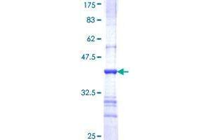 DDX20 Protein (AA 725-824) (GST tag)