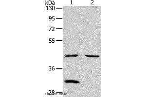 Western blot analysis of Mouse kidney and heart tissue, using NCEH1 Polyclonal Antibody at dilution of 1:1300 (NCEH1 anticorps)