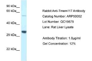 WB Suggested Anti-Tmem117 Antibody   Titration: 1. (TMEM117 anticorps  (C-Term))