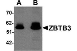 Western blot analysis of ZBTB3 in rat brain tissue lysate with ZBTB3 antibody at (A) 1 and (B) 2 μg/ml. (ZBTB3 anticorps  (C-Term))