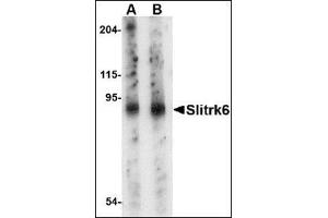 Western blot analysis of Slitrk6 in mouse lung tissue lysate with this product at (A) 0.
