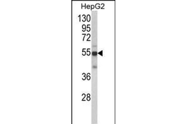 CYP2J2 anticorps  (N-Term)