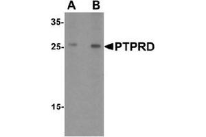 Western blot analysis of PTPRD in HeLa cell lysate with PTPRD Antibody  at (A) 1 and (B) 2 ug/mL. (PTPRD anticorps  (N-Term))