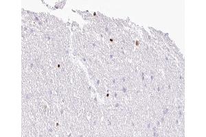 ABIN6267006 at 1/100 staining human Brain tissue sections by IHC-P. (MOK anticorps  (Internal Region))