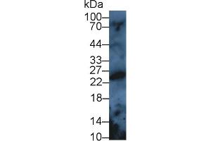 Detection of PRDX3 in Rat Serum using Polyclonal Antibody to Peroxiredoxin 3 (PRDX3) (Peroxiredoxin 3 anticorps  (AA 5-233))