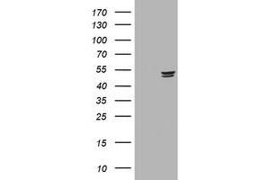Image no. 2 for anti-Thymidine Phosphorylase (TYMP) (AA 311-482) antibody (ABIN1491400) (Thymidine Phosphorylase anticorps  (AA 311-482))