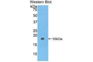 Detection of Recombinant CEA, Human using Polyclonal Antibody to Carcinoembryonic Antigen (CEA) (CEA anticorps  (AA 93-221))