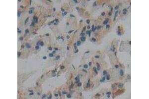 IHC-P analysis of Human Tissue, with DAB staining. (TBK1 anticorps  (AA 9-310))