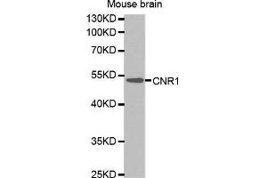 Western Blotting (WB) image for anti-Cannabinoid Receptor 1 (CNR1) (AA 1-120) antibody (ABIN6218536) (CNR1 anticorps  (AA 1-120))
