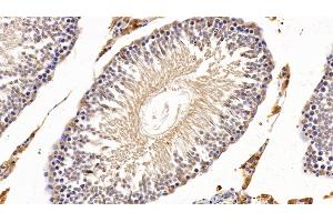 Detection of CYP1A1 in Rat Testis Tissue using Polyclonal Antibody to Cytochrome P450 1A1 (CYP1A1)