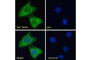 ABIN1590015 Immunofluorescence analysis of paraformaldehyde fixed HeLa cells, permeabilized with 0.