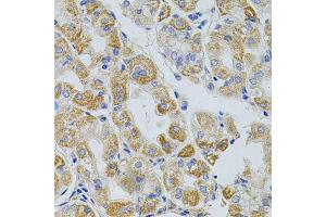 Immunohistochemistry of paraffin-embedded human stomach using PCSK9 antibody (ABIN5975791) at dilution of 1/100 (40x lens). (PCSK9 anticorps)