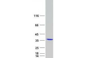 Validation with Western Blot